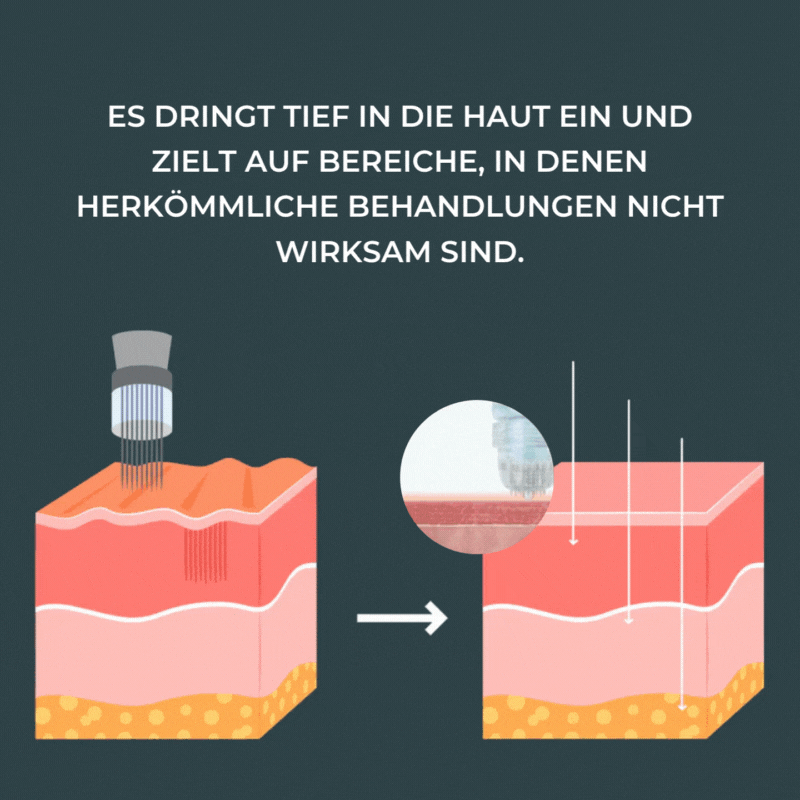 Micro-Infusion Anti-Aging Kit™